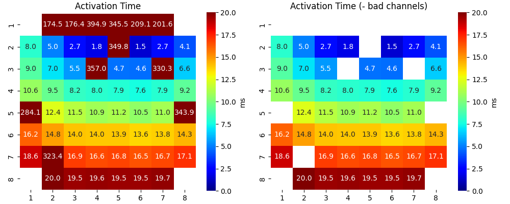 Activation Time, Activation Time (- bad channels)