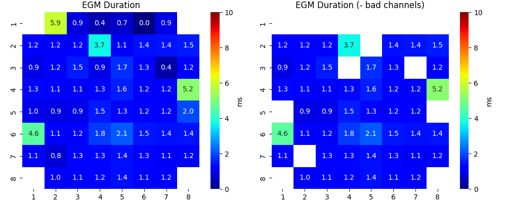 EGM Duration, EGM Duration (- bad channels)