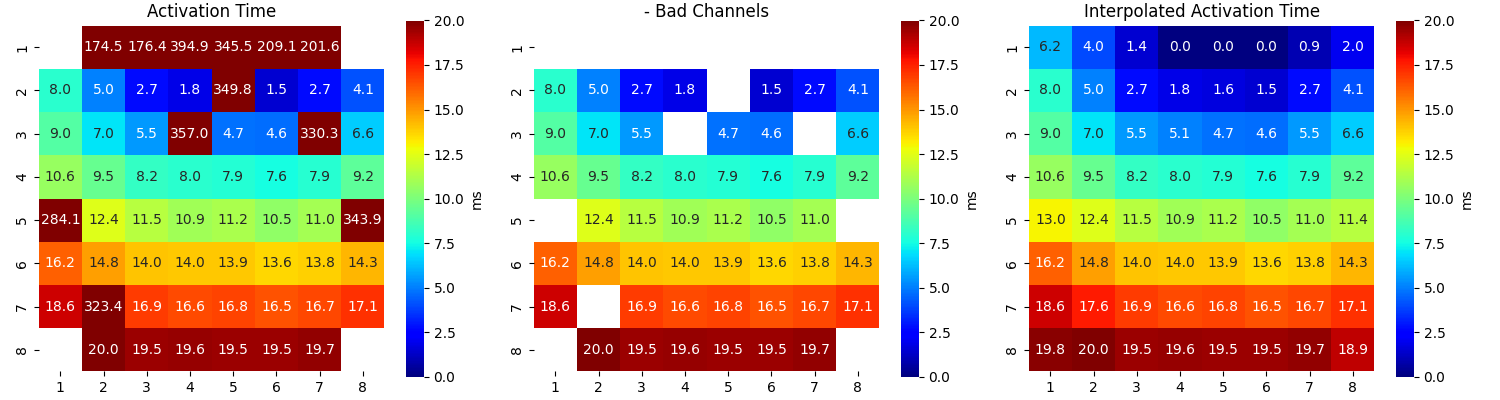 Activation Time, - Bad Channels, Interpolated Activation Time