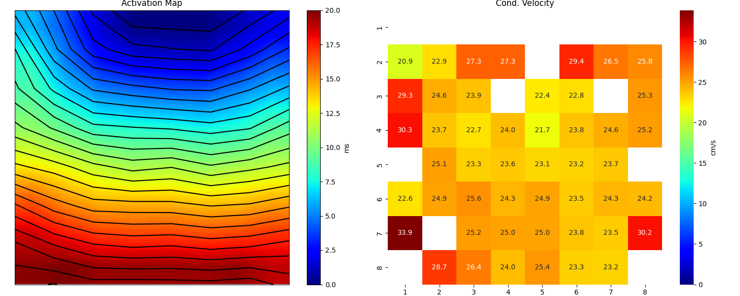 Activation Map, Cond. Velocity