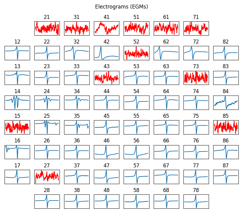 Electrograms (EGMs), 47, 48, 46, 45, 38, 37, 28, 36, 27, 17, 26, 16, 35, 25, 15, 14, 24, 34, 13, 23, 12, 22, 33, 21, 32, 31, 44, 43, 41, 42, 52, 51, 53, 54, 61, 62, 71, 63, 72, 82, 73, 83, 64, 74, 84, 85, 75, 65, 86, 76, 87, 77, 66, 78, 67, 68, 55, 56, 58, 57