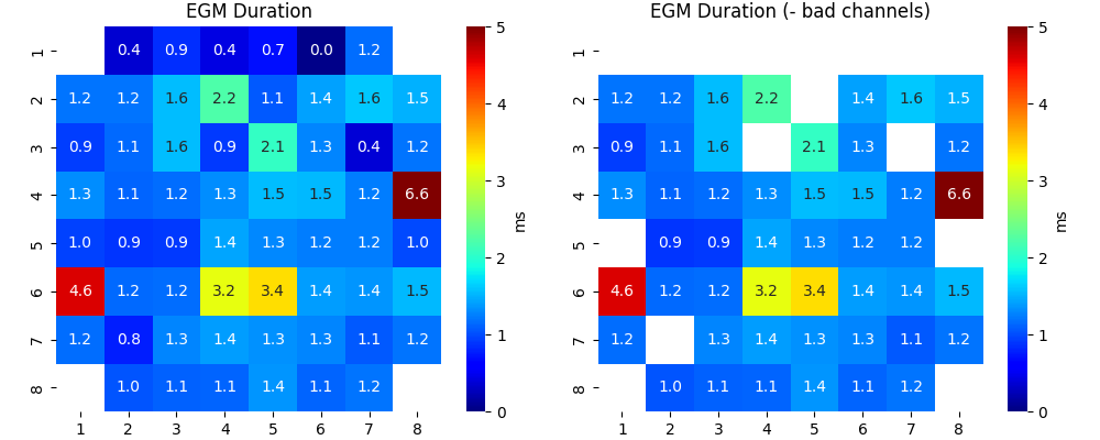 EGM Duration, EGM Duration (- bad channels)