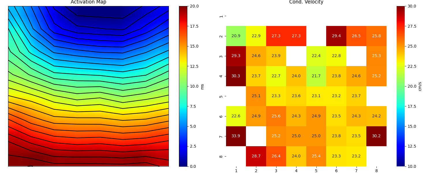 Activation Map, Cond. Velocity