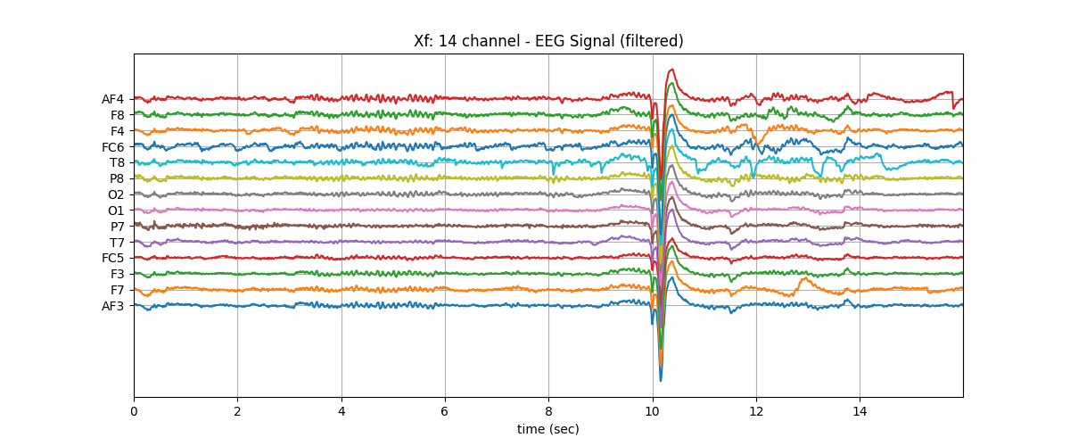 Xf: 14 channel - EEG Signal (filtered)