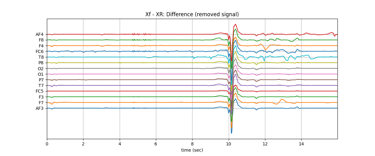 Xf - XR: Difference (removed signal)