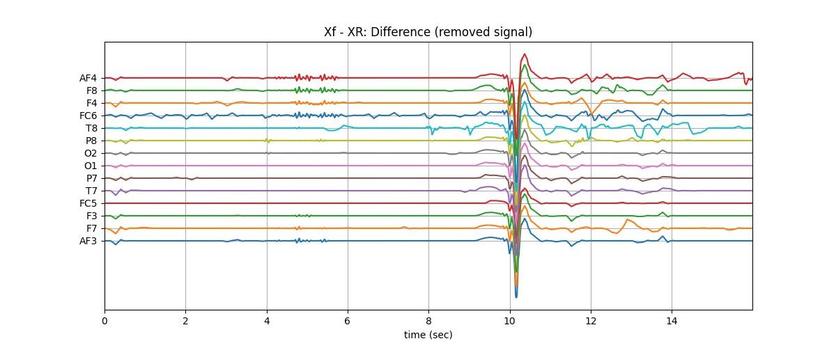 Xf - XR: Difference (removed signal)