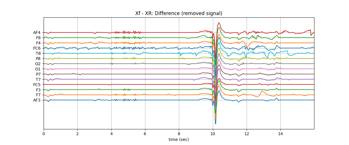 Xf - XR: Difference (removed signal)