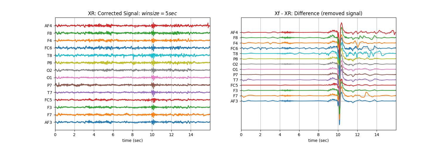 XR: Corrected Signal: $winsize=5sec$, Xf - XR: Difference (removed signal)