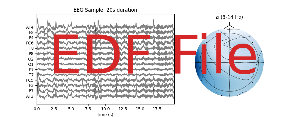 EEG Sample: 20s duration, $\alpha$ (8-14 Hz)