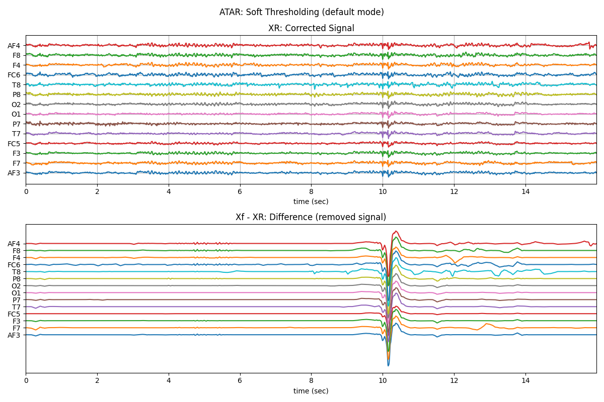 ATAR: Soft Thresholding (default mode), XR: Corrected Signal, Xf - XR: Difference (removed signal)