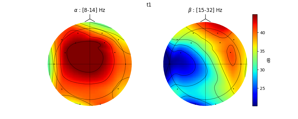 t1, $\alpha$ : [8-14] Hz, $\beta$ : [15-32] Hz