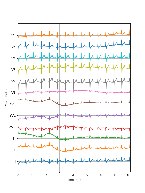 ../../_images/spkit-data-ecg_sample_12leads-1.png