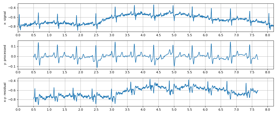 ../../_images/spkit-filtering_pipeline-1.png