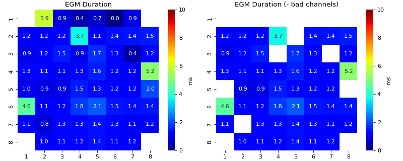 ../../_images/spkit-mea-analyse_mea_file-1_06.png