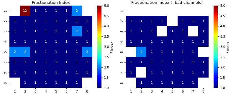 ../../_images/spkit-mea-analyse_mea_file-1_07.png