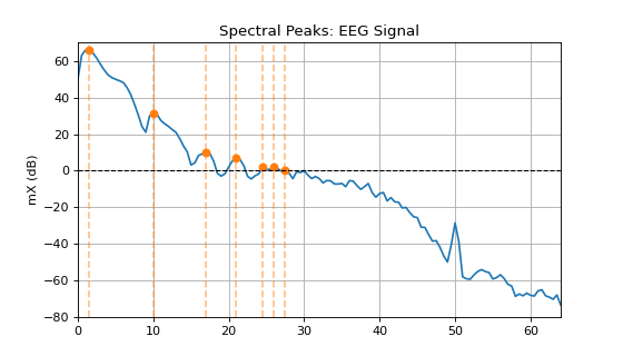 ../../_images/spkit-peak_detection-1_00_00.png