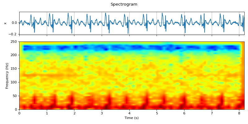 ../../_images/spkit-stft_analysis-1_00_00.png